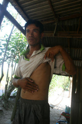 Lộ diện đường dây “cò” thận xuyên quốc gia